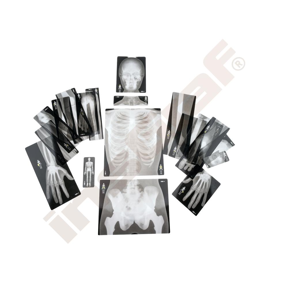 Röntgenbild eines menschlichen Skeletts