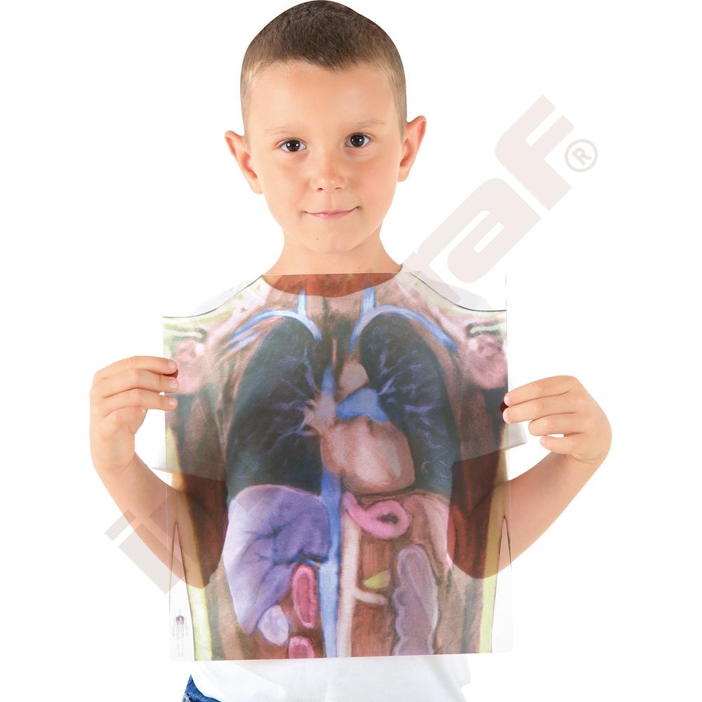 Zjisti co máme pod kůži - rentgenový snímek 