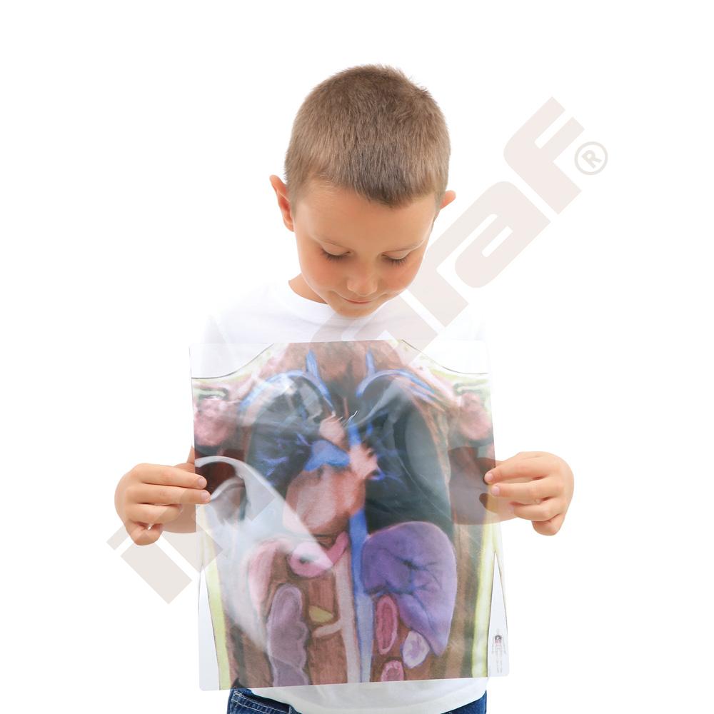 Zjisti co máme pod kůži - rentgenový snímek 