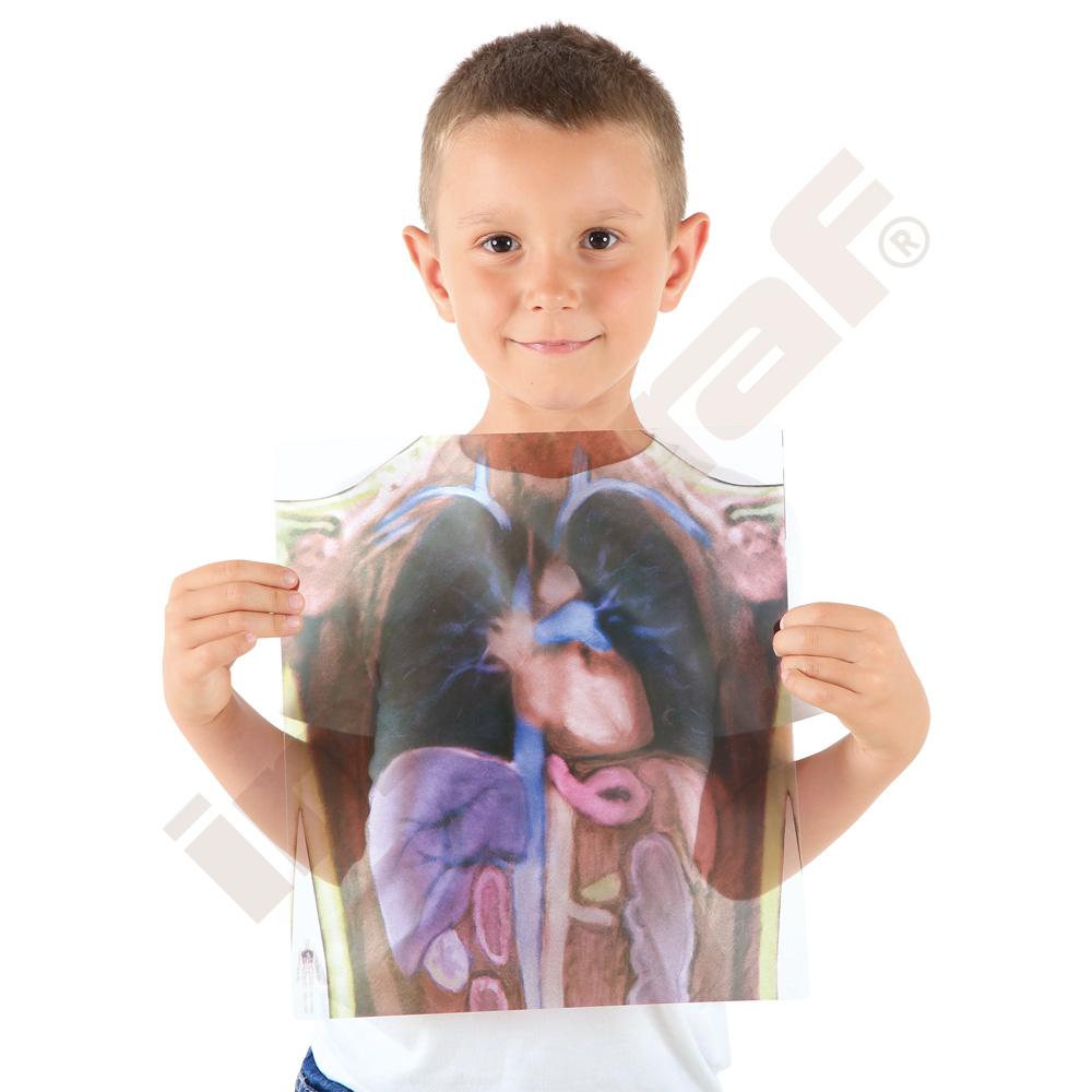 Zjisti co máme pod kůži - rentgenový snímek 